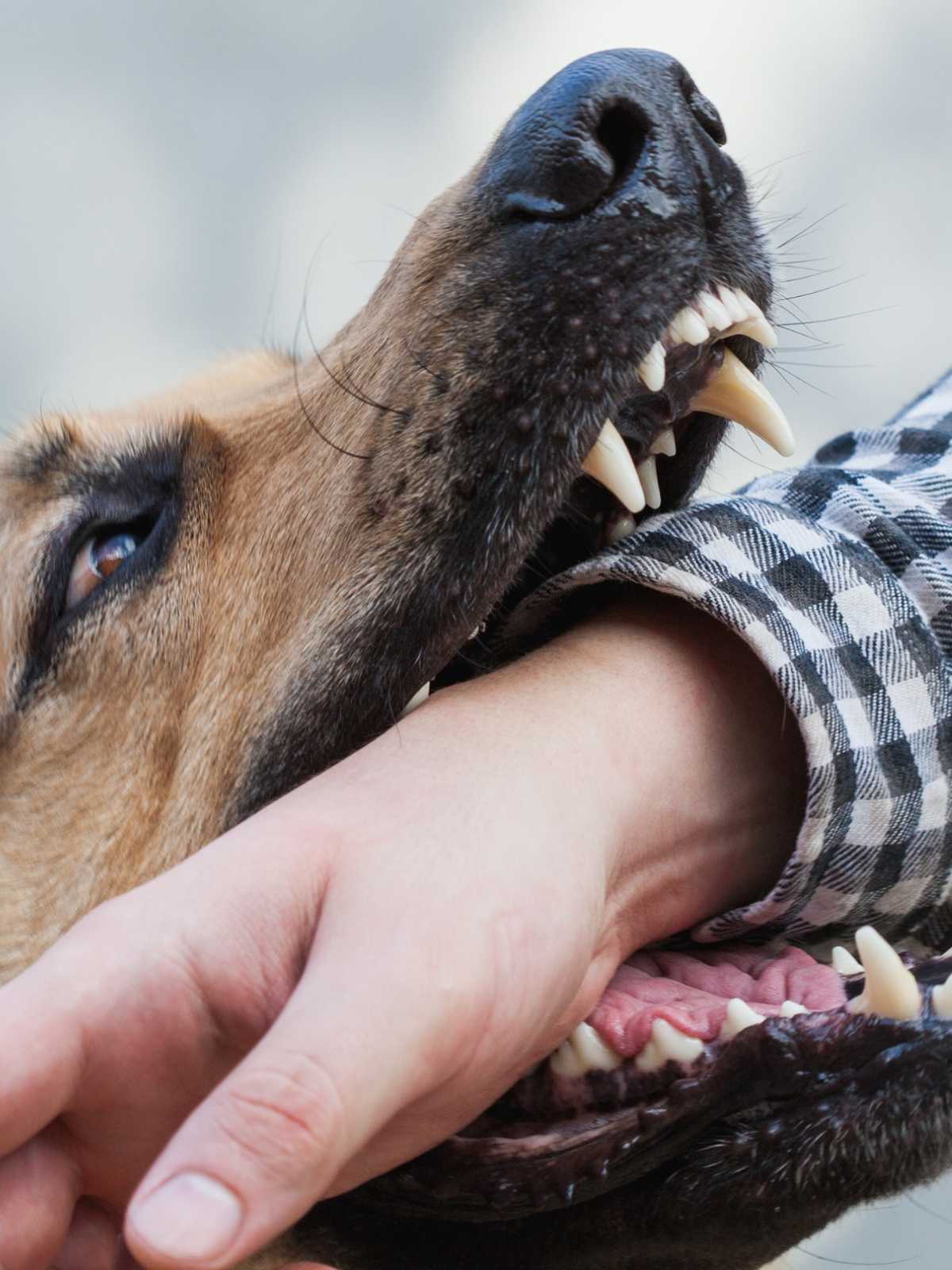 perro mordiendo brazo